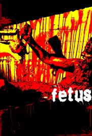 Fetus Fetus