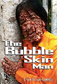 The Bubble Skin Man