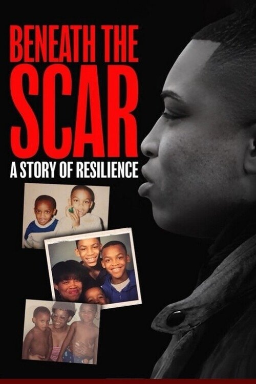 Beneath the Scar: A Story of Resilience Beneath the Scar: A Story of Resilience