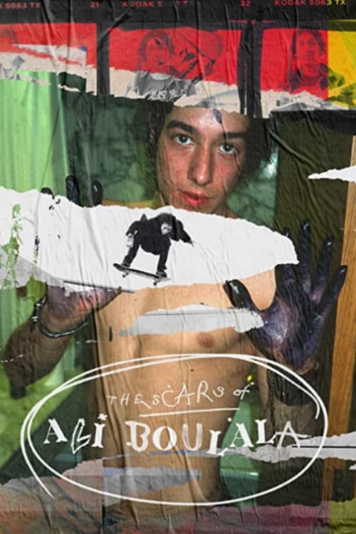 The Scars of Ali Boulala The Scars of Ali Boulala