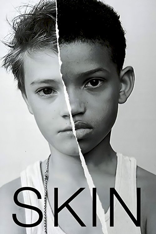 Skin Skin