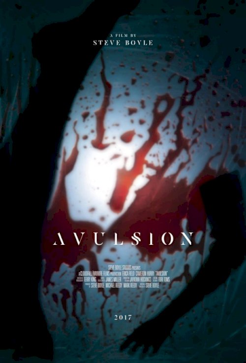 Avulsion
