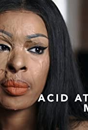 Acid Attack: My Story Acid Attack: My Story