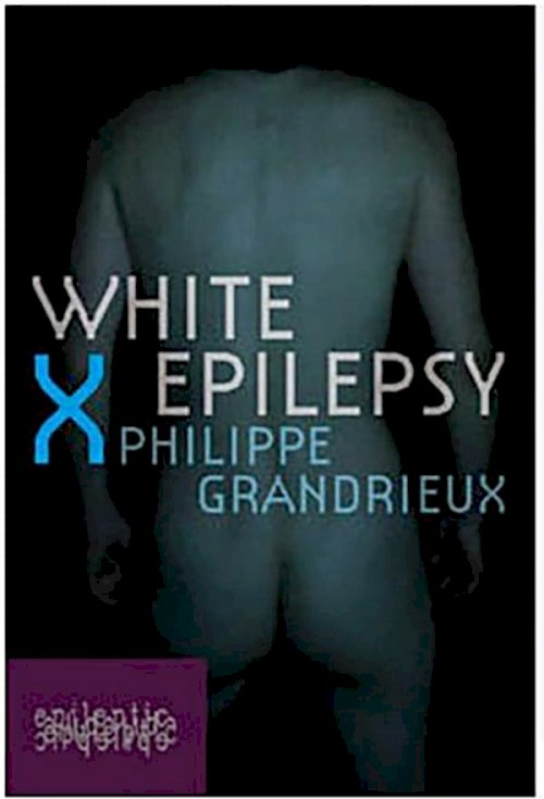 White Epilepsy White Epilepsy