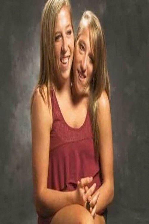 The Twins Who Share A Body The Twins Who Share A Body