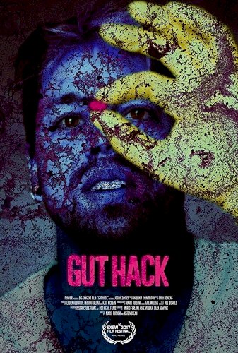 Gut Hack Gut Hack