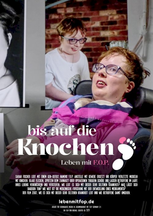 Bis auf die Knochen - Leben mit FOP Bis auf die Knochen - Leben mit FOP