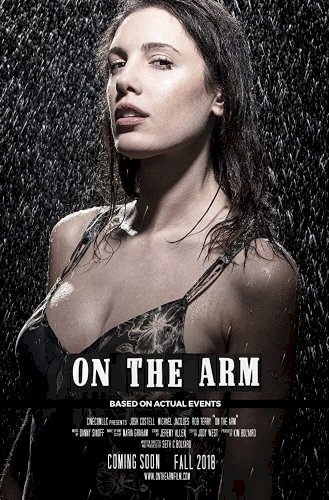 On the Arm On the Arm