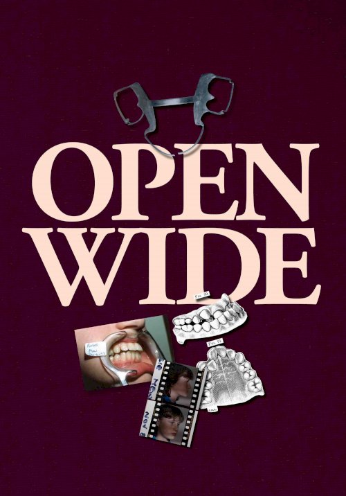 Open Wide Open Wide